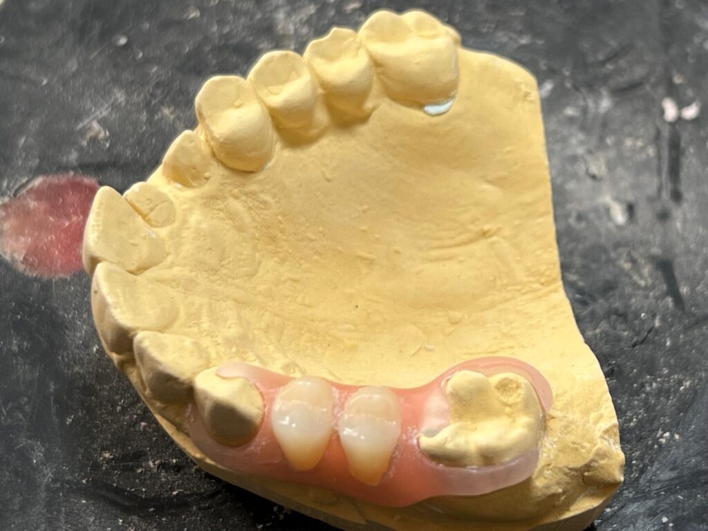 Flexite Lion Dental