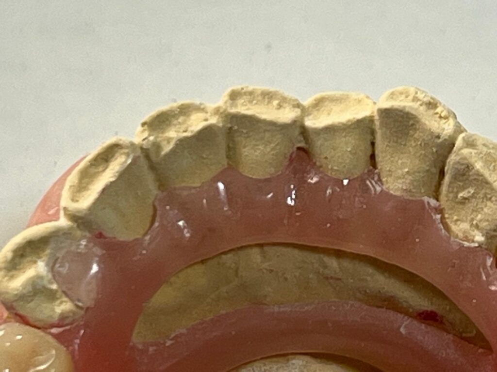 Flexite Lion Dental
